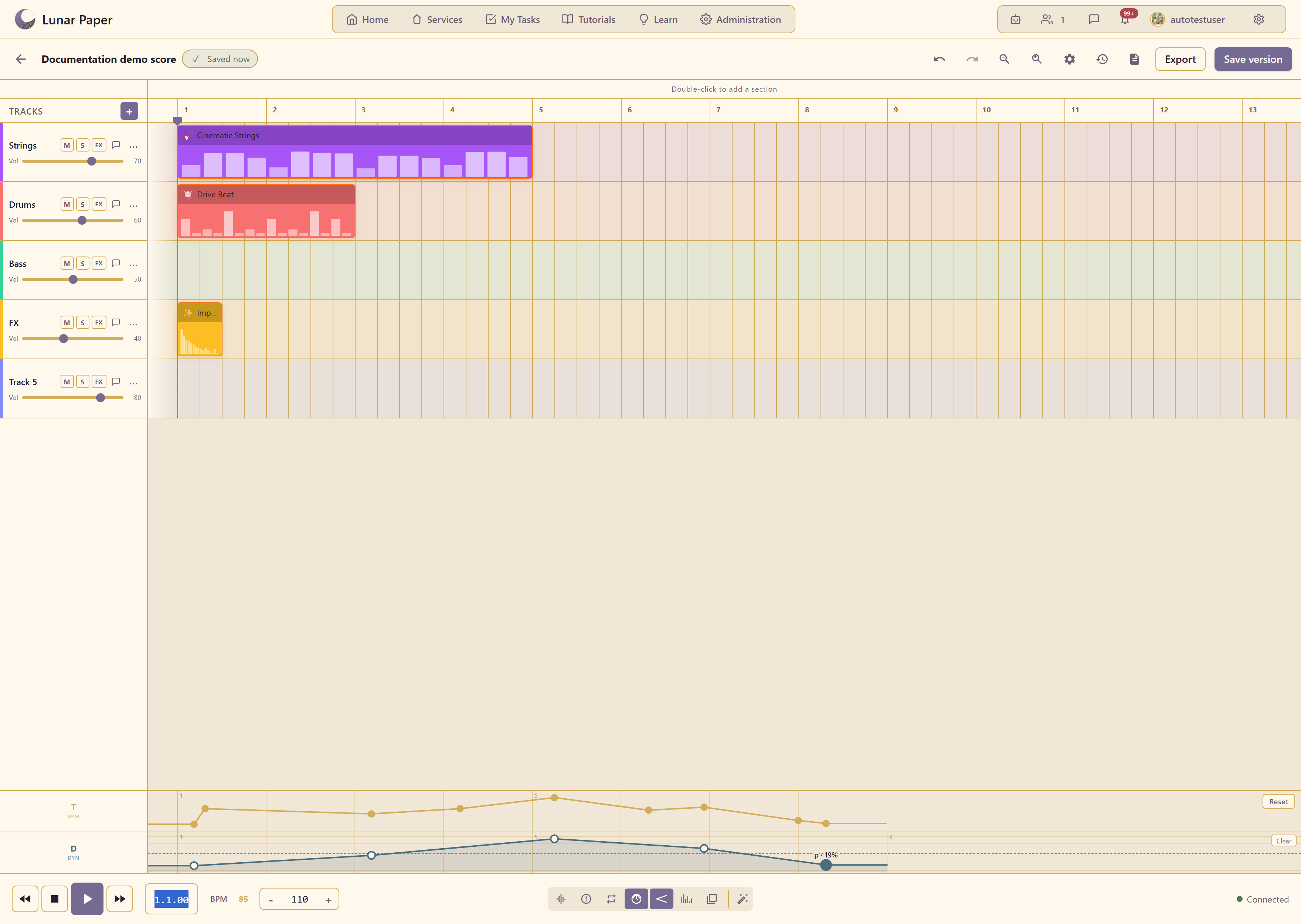 The editor with the tempo and dynamics lanes open under the timeline